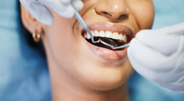 Best Emergency Denture Repair in Thompsonville, CT