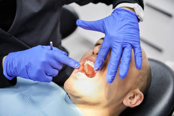 Best Knocked-Out Tooth (Avulsed Tooth) Treatment in Thompsonville, CT